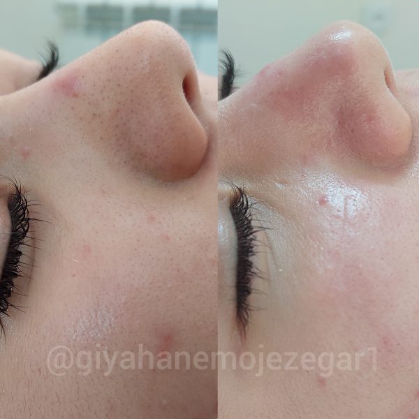 Polish_۲۰۲۲۰۹۰۳_۰۱۵۴۰۰۷۸۰