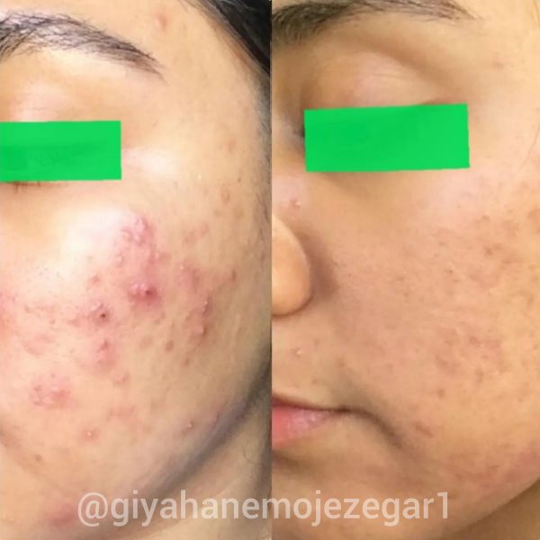 Polish_۲۰۲۲۰۹۰۳_۰۲۳۵۲۲۹۹۴