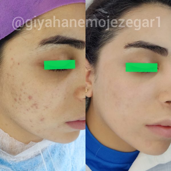 Polish_۲۰۲۲۰۹۰۳_۲۰۱۷۵۷۸۸۴