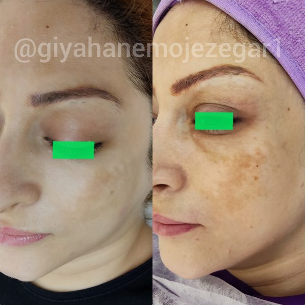 Polish_۲۰۲۲۰۹۰۳_۲۰۵۶۳۶۸۲۱