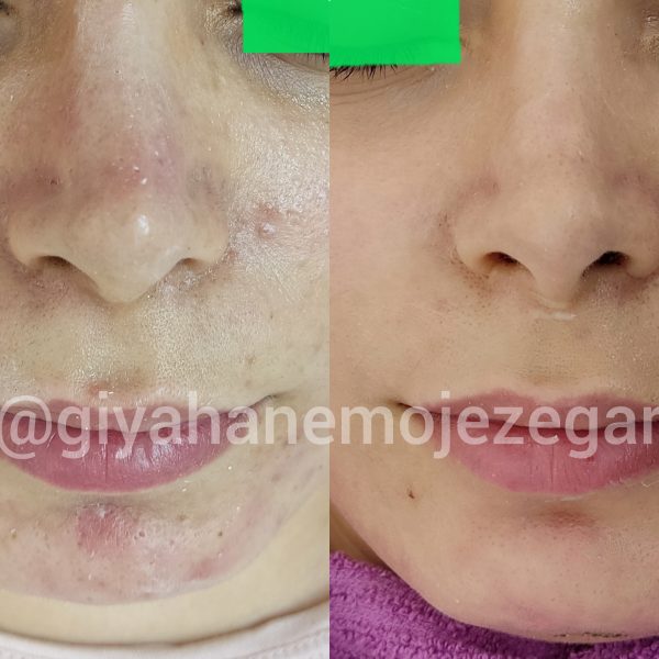 Polish_۲۰۲۲۱۱۰۶_۰۹۵۱۱۹۵۳۱