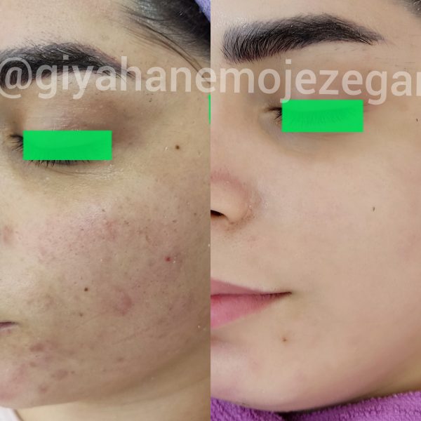 Polish_۲۰۲۲۱۱۰۶_۰۹۵۶۴۶۵۶۷