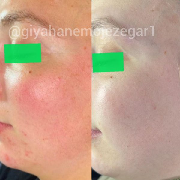 Polish_۲۰۲۲۱۱۰۶_۱۰۱۹۳۱۵۵۷