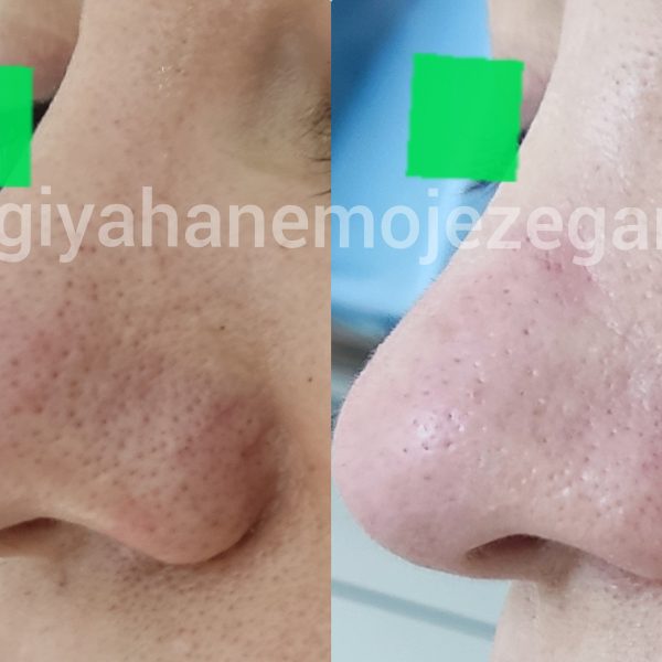 Polish_۲۰۲۲۱۱۰۷_۱۱۳۴۰۳۹۸۱