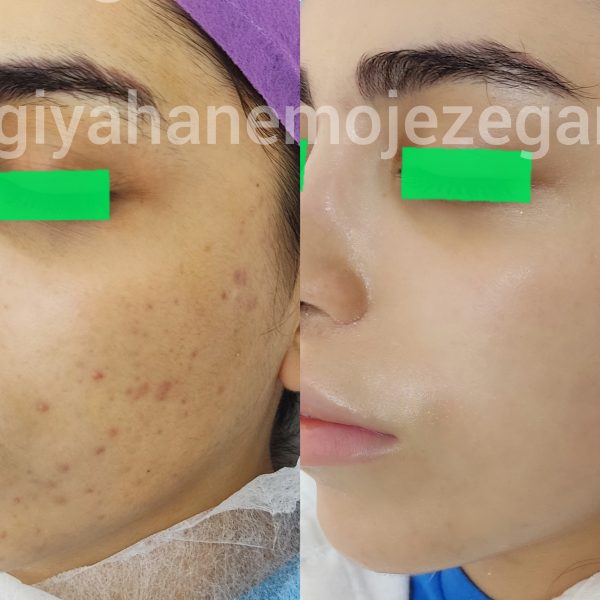 Polish_۲۰۲۲۱۱۰۷_۱۱۳۷۰۷۳۳۵