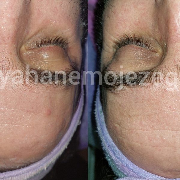 Polish_۲۰۲۲۱۱۰۹_۱۸۴۷۴۰۷۹۰