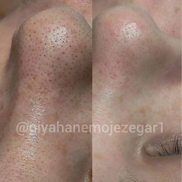 Polish_۲۰۲۲۱۱۱۲_۱۰۵۸۱۶۸۶۶